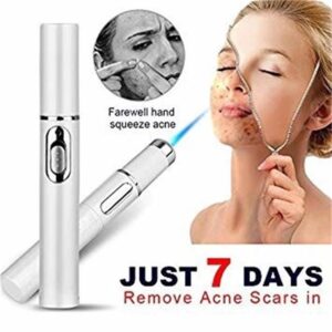 Blue Light Therapy Pen – Acne, Scar & Wrinkle Treatment Devic