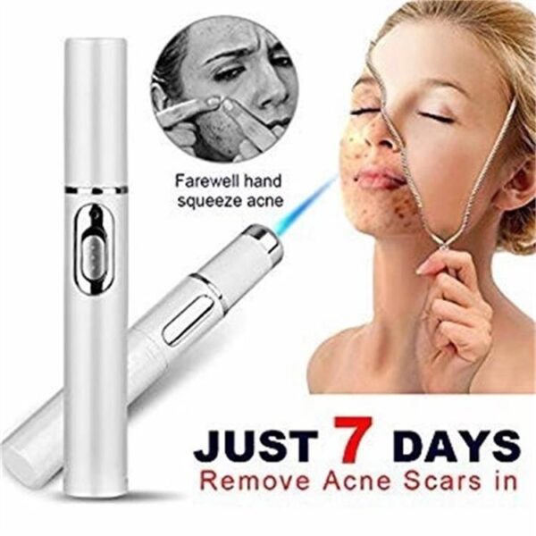 Blue Light Therapy Pen – Acne, Scar & Wrinkle Treatment Devic