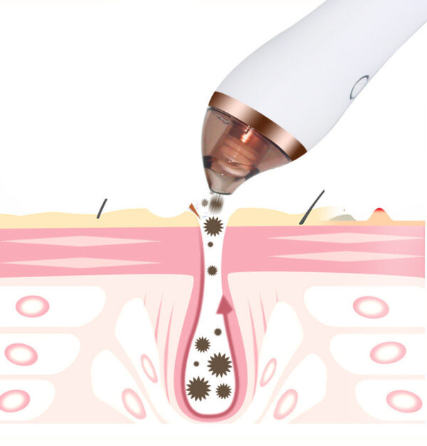 4-in-1 Beauty Device – Guasha, Cupping, Blackhead Removal & Deep Facial Cleansing