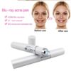 Blue Light Therapy Pen – Acne, Scar & Wrinkle Treatment Devic