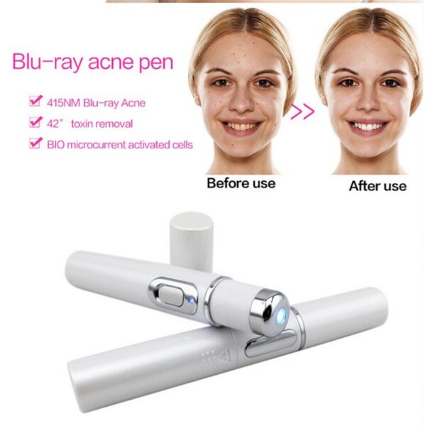 Blue Light Therapy Pen – Acne, Scar & Wrinkle Treatment Devic