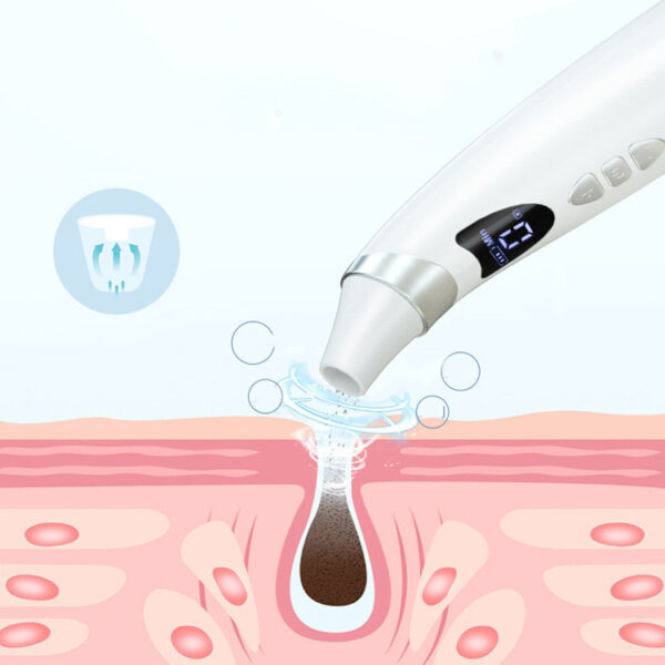 Electric Visual Blackhead Remover – Pore Vacuum & Skin Cleansing Tool