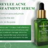 Acne Treatment Serum Facial Repair Oil