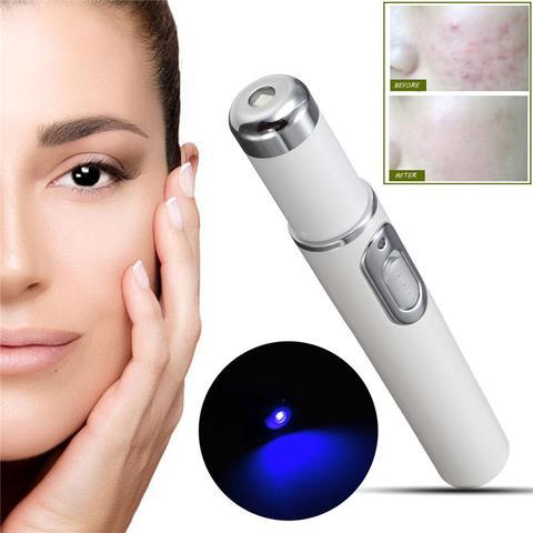 Blue Light Therapy Pen – Acne, Scar & Wrinkle Treatment Devic